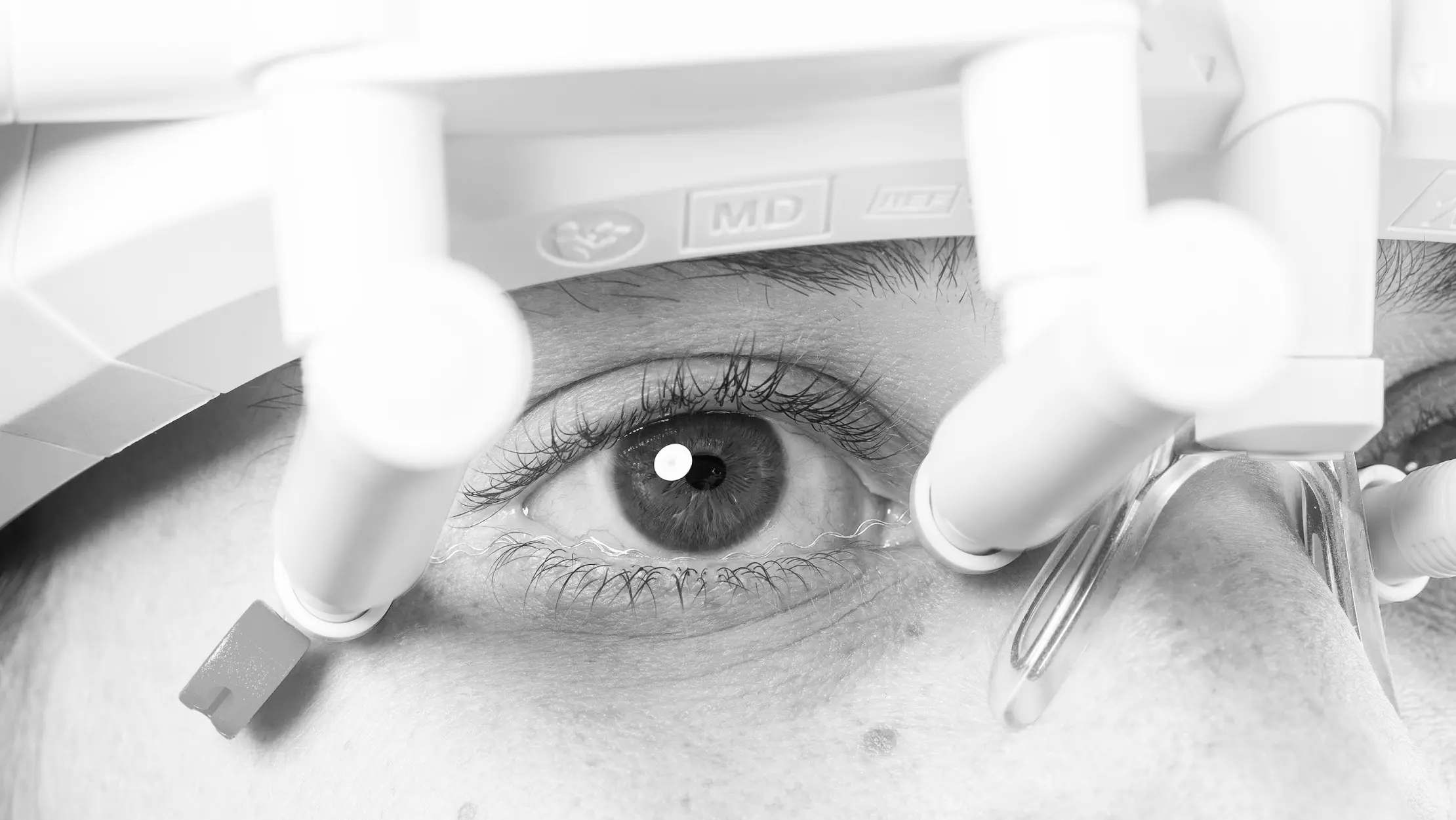 OkuStim® 2 – Nahaufnahme des Geräts am Auge